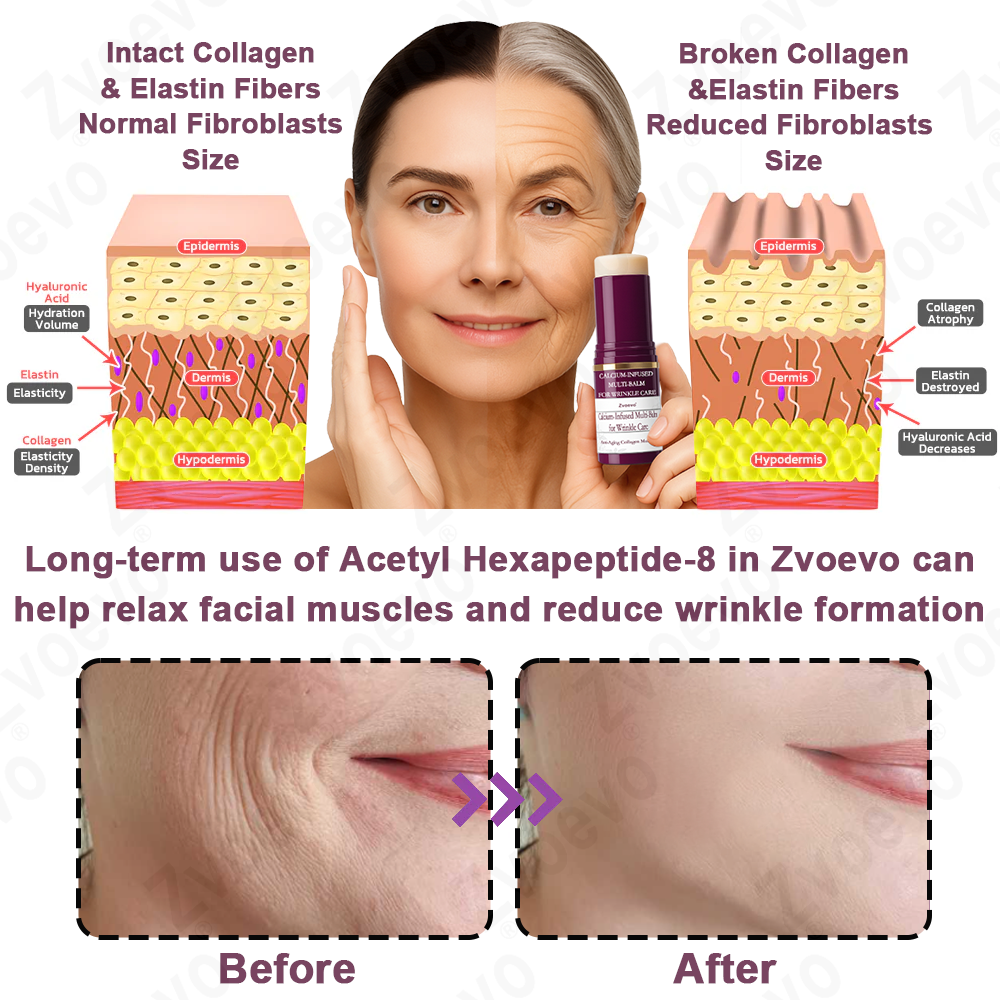 ✅ Official Flagship Store: Zvoevo® Calcium Collagen Repair Lip Balm 👩‍⚕️ FDA Certified (For wrinkles and fine lines, smooths glabellar lines and neck wrinkles, reduces crow's feet)