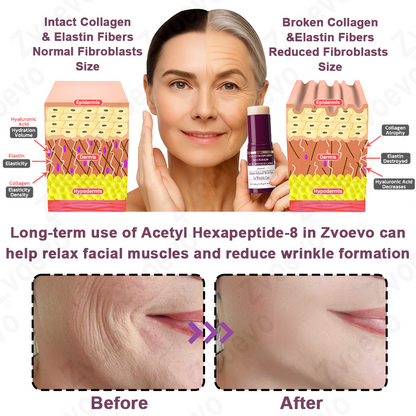 ✅ Official Flagship Store: Zvoevo® Calcium Collagen Repair Lip Balm 👩‍⚕️ FDA Certified (For wrinkles and fine lines, smooths glabellar lines and neck wrinkles, reduces crow's feet)