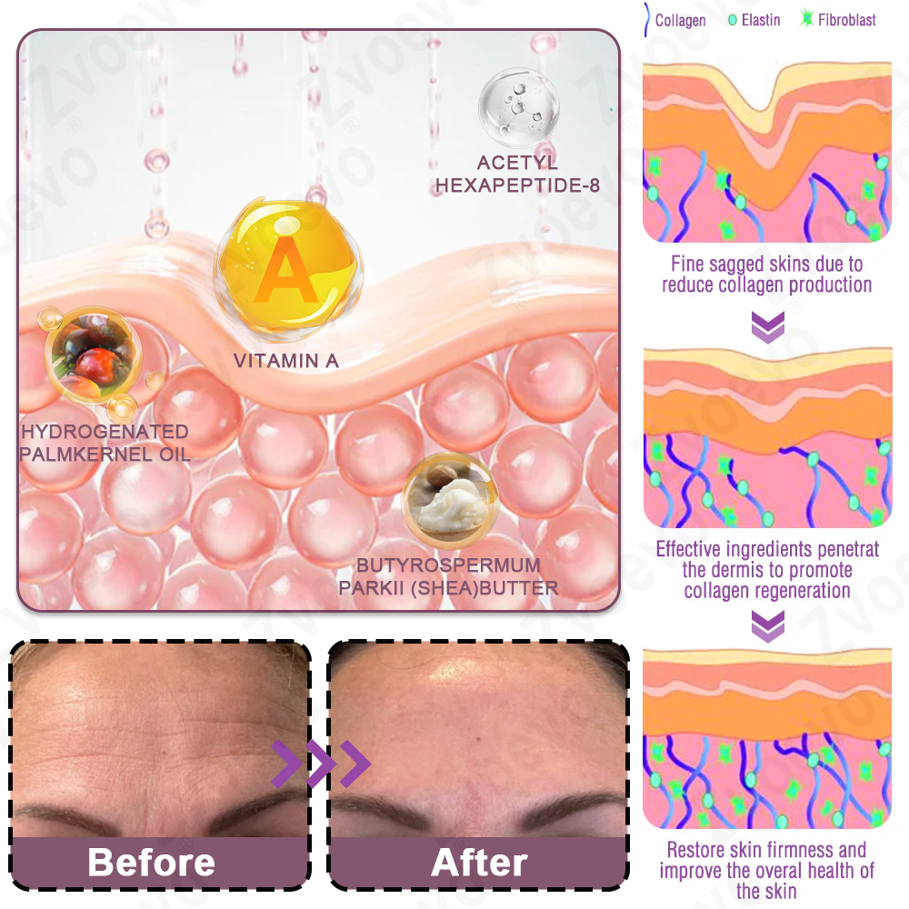 ✅ Official Flagship Store: Zvoevo® Calcium Collagen Repair Lip Balm 👩‍⚕️ FDA Certified (For wrinkles and fine lines, smooths glabellar lines and neck wrinkles, reduces crow's feet)