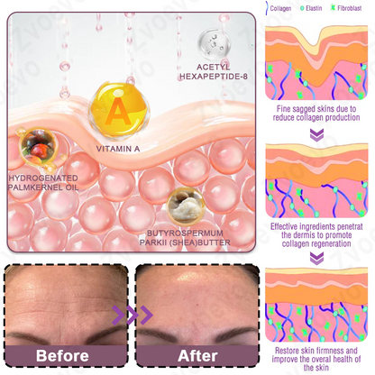 ✅ Official Flagship Store: Zvoevo® Calcium Collagen Repair Lip Balm 👩‍⚕️ FDA Certified (For wrinkles and fine lines, smooths glabellar lines and neck wrinkles, reduces crow's feet)