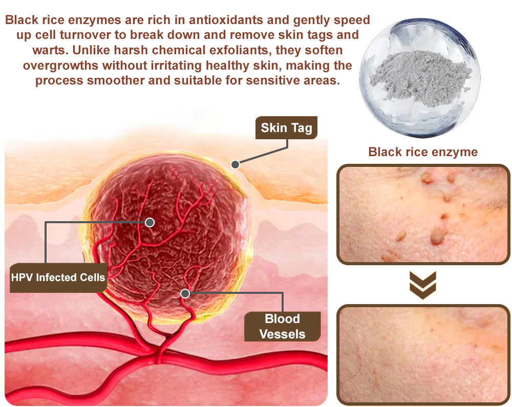 Zvoevo® Black Rice Essence Cream👨‍⚕️ FDA Certified (Removes Skin Growths and Warts, Improves Actinic Keratosis and Purpura, Skin Cancer and Age Spots)