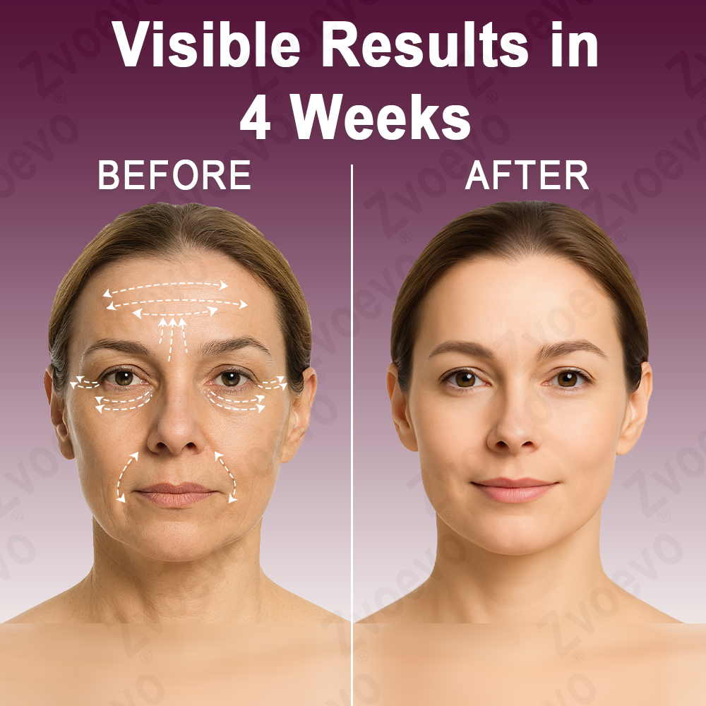 ✅ Official Flagship Store: Zvoevo® Calcium Collagen Repair Lip Balm 👩‍⚕️ FDA Certified (For wrinkles and fine lines, smooths glabellar lines and neck wrinkles, reduces crow's feet)