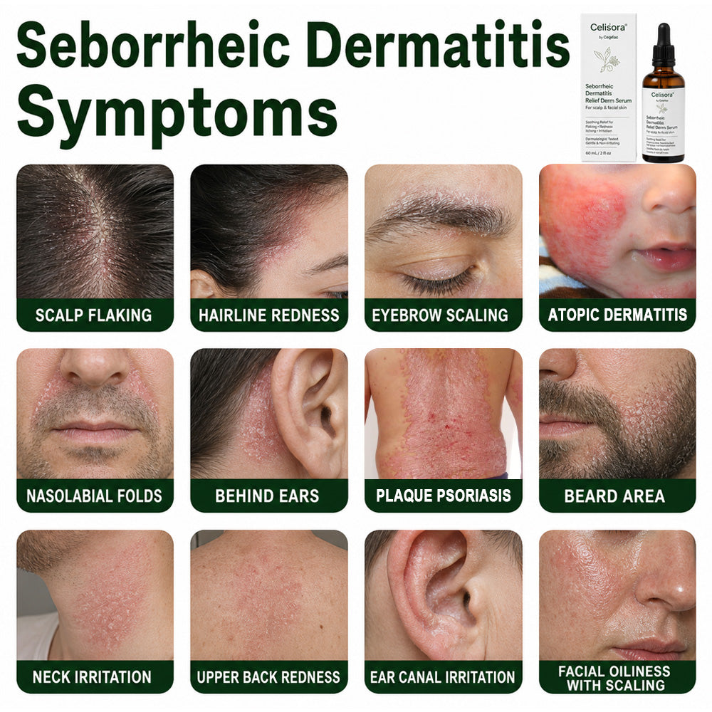 🟢Celsiora® Seborrheic Dermatitis Relief Derm Serum