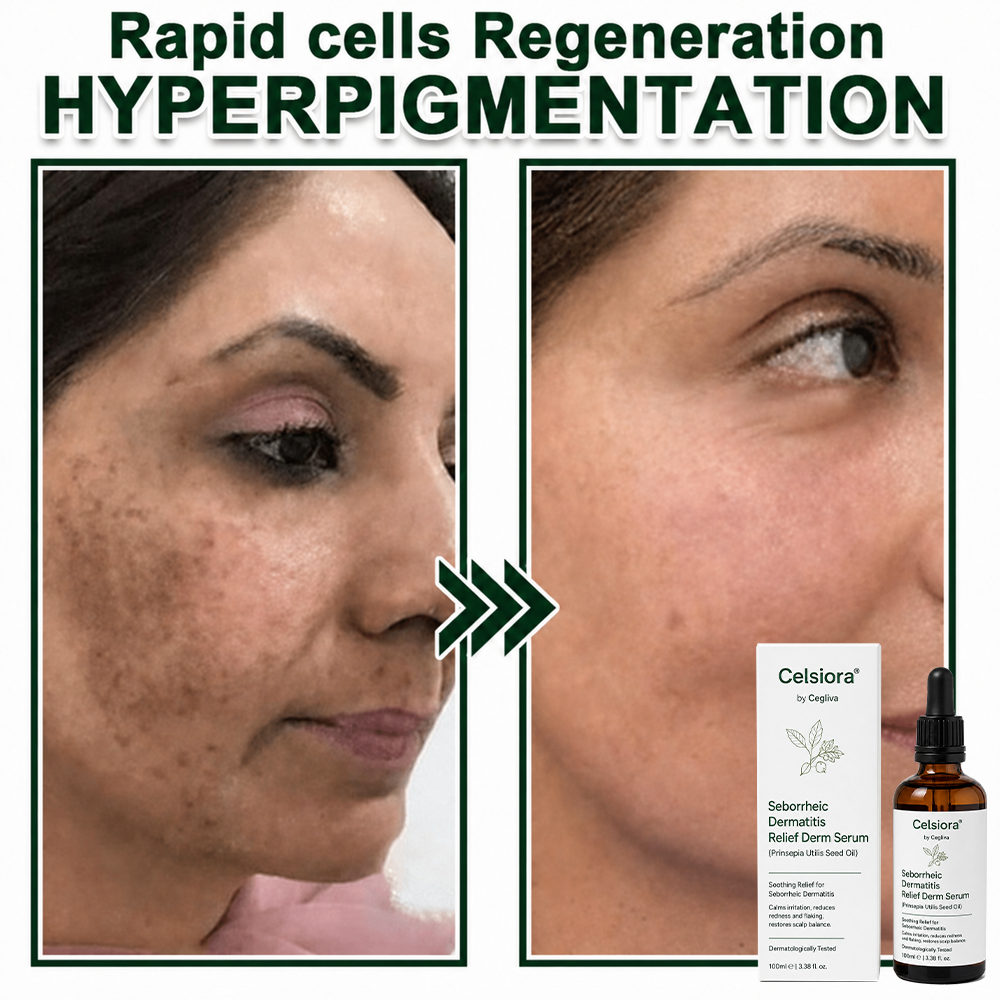 🟢Celsiora® Seborrheic Dermatitis Relief Derm Serum