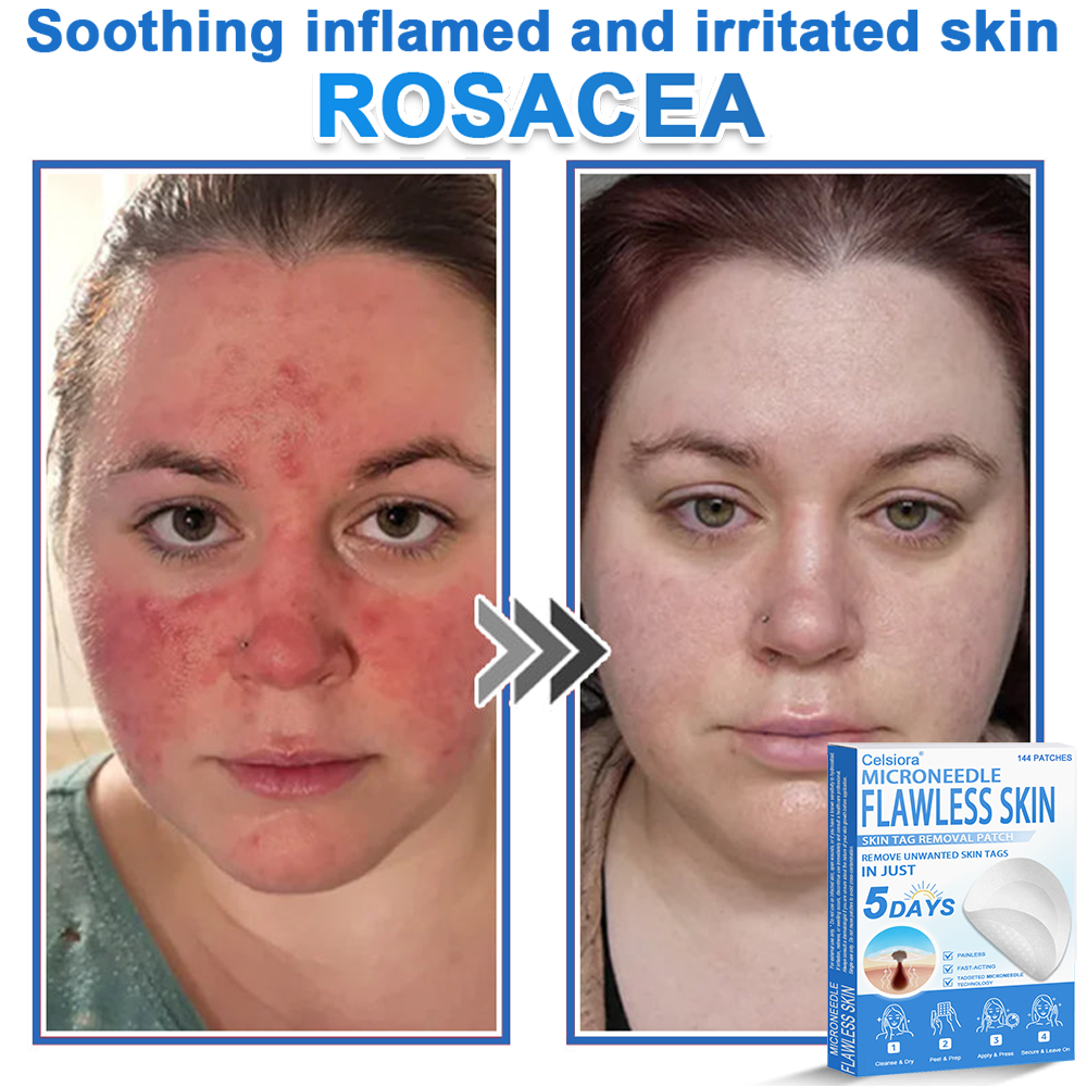 ✅ Celsiora® 2-in-1 Microneedle & Hydrocolloid Patch | Raised Moles,Acne,  Flat Warts & Skin Tags Remover | Improves Wrinkles, Scars & Blemishes | Invisible Pimple Patches for Face & Body