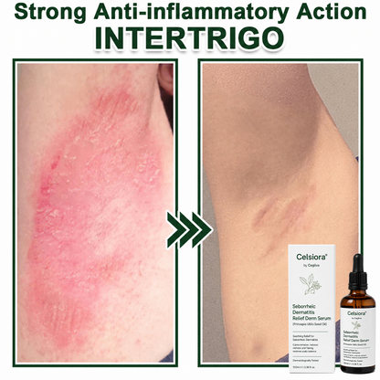 🟢Celsiora® Seborrheic Dermatitis Relief Derm Serum