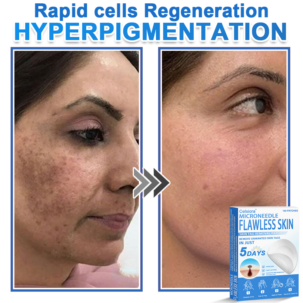 ✅ Celsiora® 2-in-1 Microneedle & Hydrocolloid Patch | Raised Moles,Acne,  Flat Warts & Skin Tags Remover | Improves Wrinkles, Scars & Blemishes | Invisible Pimple Patches for Face & Body