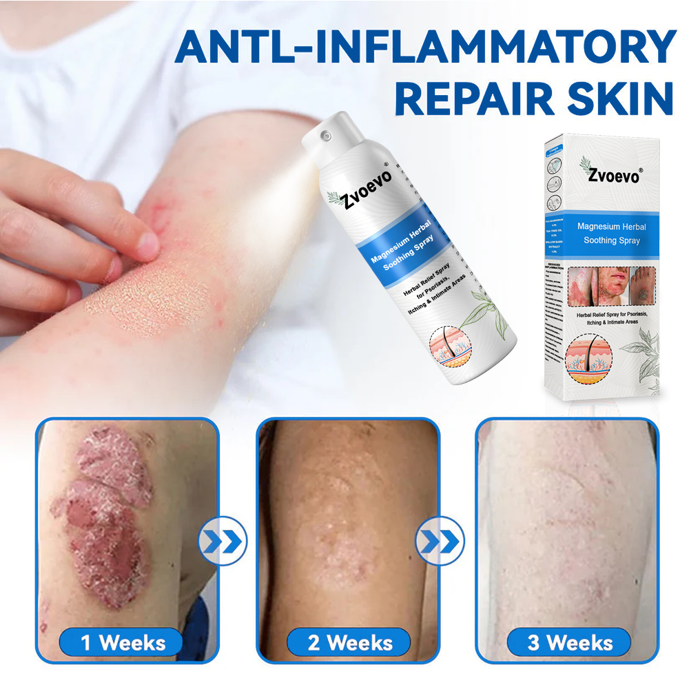 USA 80%OFF✅Official Store: Zvoevo®Magnesium Herbal Psoriasis Spray⚕️FDA Certified (Eliminates psoriasis and eczema, treats bacterial infections in the genital area, relieves joint pain and neuropathic pain, and treats acne and pigmentation) (Copy)