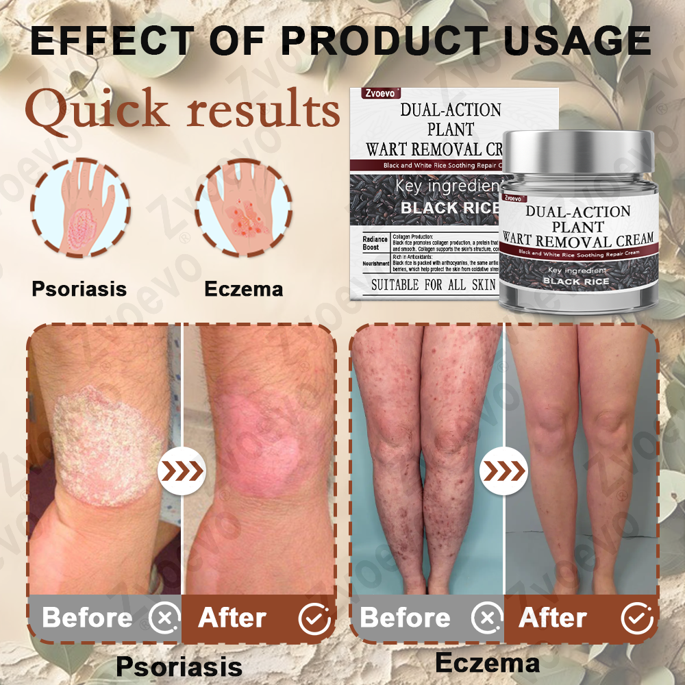 Zvoevo® Black Rice Essence Cream👨‍⚕️ FDA Certified (Removes Skin Growths and Warts, Improves Actinic Keratosis and Purpura, Skin Cancer and Age Spots)
