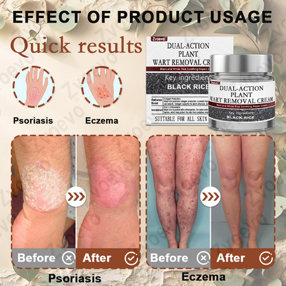 Zvoevo® Black Rice Essence Cream👨‍⚕️ FDA Certified (Removes Skin Growths and Warts, Improves Actinic Keratosis and Purpura, Skin Cancer and Age Spots)