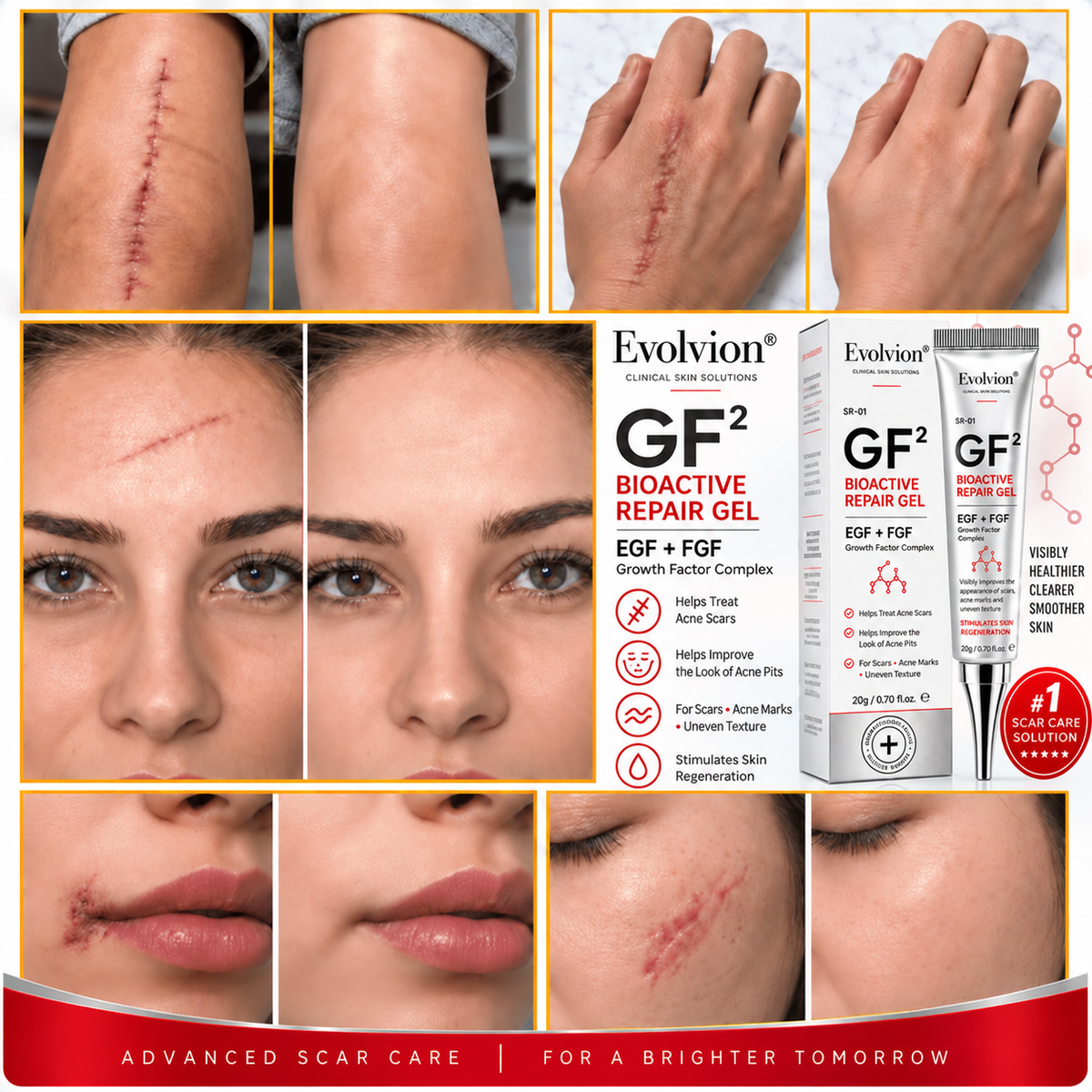 Evolviion GF² Advanced Bioactive Scar Repair Gel👨‍⚕️(For Hypertrophic Scars/Post-Surgical Scars/Stretch Marks/Acne Scars)