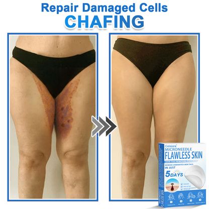 ✨Celsiora® 2-in-1 Microneedle & Hydrocolloid Patch | Raised Moles,Acne,  Flat Warts & Skin Tags Remover | Improves Wrinkles, Scars & Blemishes | Invisible Pimple Patches for Face & Body