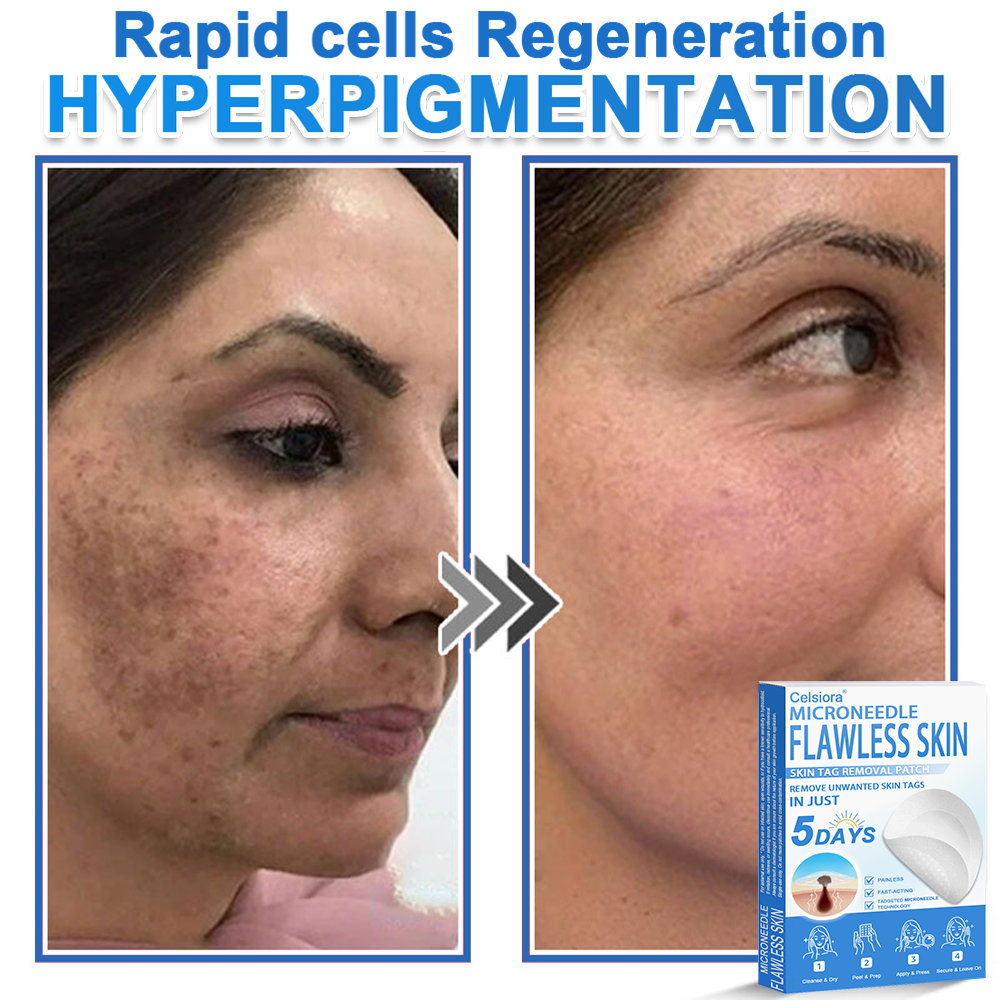 ✨Celsiora® 2-in-1 Microneedle & Hydrocolloid Patch | Raised Moles,Acne,  Flat Warts & Skin Tags Remover | Improves Wrinkles, Scars & Blemishes | Invisible Pimple Patches for Face & Body