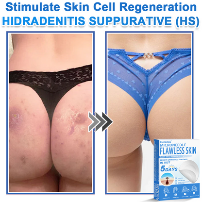 ✨Celsiora® 2-in-1 Microneedle & Hydrocolloid Patch | Raised Moles,Acne,  Flat Warts & Skin Tags Remover | Improves Wrinkles, Scars & Blemishes | Invisible Pimple Patches for Face & Body