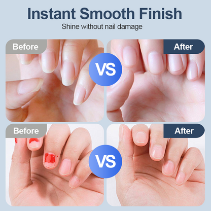 💥LAST DAY SALE 50% OFF💥Universal Automatic Fingernail Grinder for Adults and Children